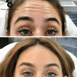 Perfect Doctors Clinic Dubai Rhinoplasty BBL Liposuction Gynecomastia tummy tuck facelift Breast body lift butt fillers botox