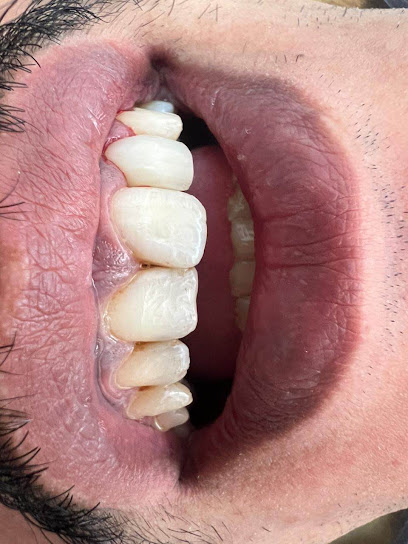 Dr Rana abu hannoud. د رنا ابو هنود