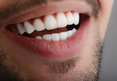 عيادات ايسمايل لطب الأسنان