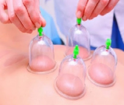 مركز وقاية وعلاج للحجامة