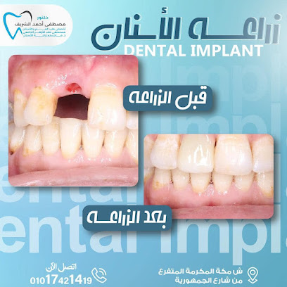 المركز التخصصي لزراعة الاسنان د مصطفى الشريف