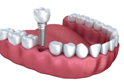 عيادة الدكتور عبدالرحمن هاشم لطب الفم والأسنان