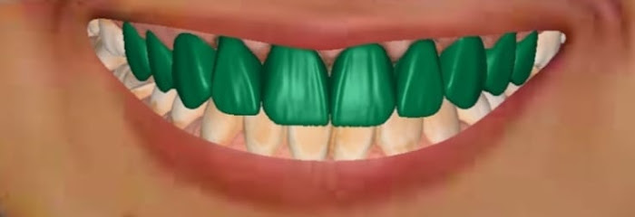 معمل السن الماسي لتركيبات الأسنان