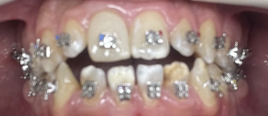 عيادة أبها سمايل لطب الأسنان