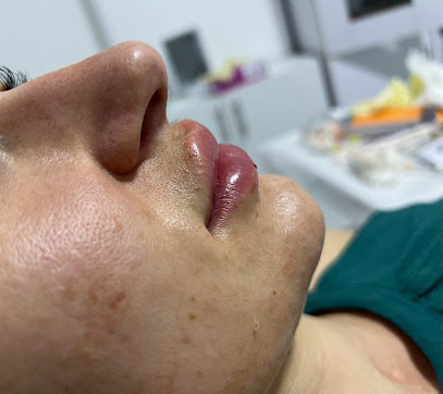 Beauty Botox Bar Hurghada