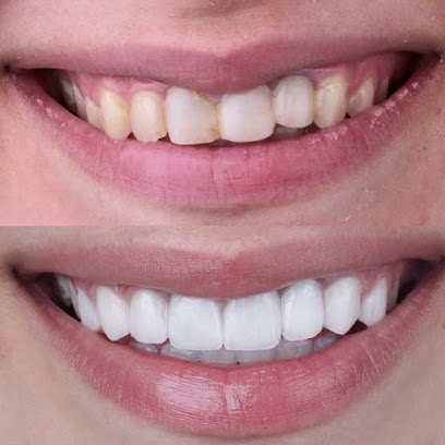 Dr. Osama Abozeid Dental Center