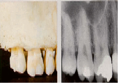 مركز أسنان ابتسامة د/ هشام محمد عبد السلام