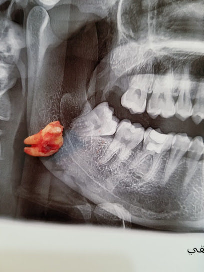 عيادة سمايل كير لطب الاسنان