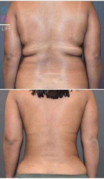 Androderma Laser Clinic