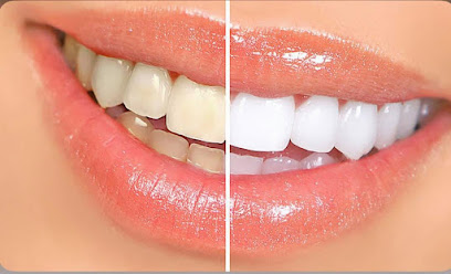 Dr Beshoy Malak Dental Clinic | عيادة أسنان دكتور بيشوي ملاكu200e