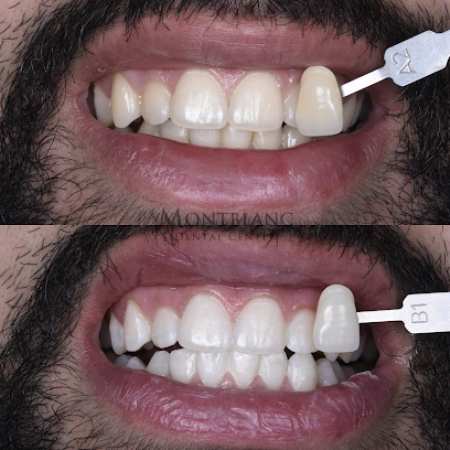 Montblanc Dental Center | Hollywood Smile, Implants, Invisalign, Orthodontist, Veneers, Teeth Whitening, Dentist Marrakech
