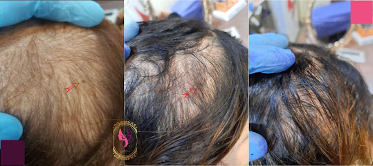 omar derma clinic عيادة الدكتور عمر يوسف العلاف للامراض الجلدية والتجميل والليزر