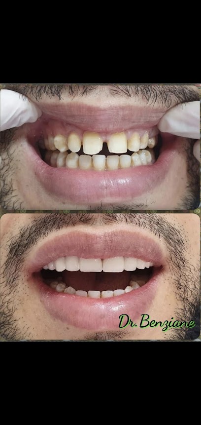 Cabinet Dentaire Dr. Benziane Ihsane, Dr.Benziane Imane