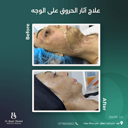 عيادات د. باسل عبيدات جراحة تجميلية | جلدية | بشرة | ليزر