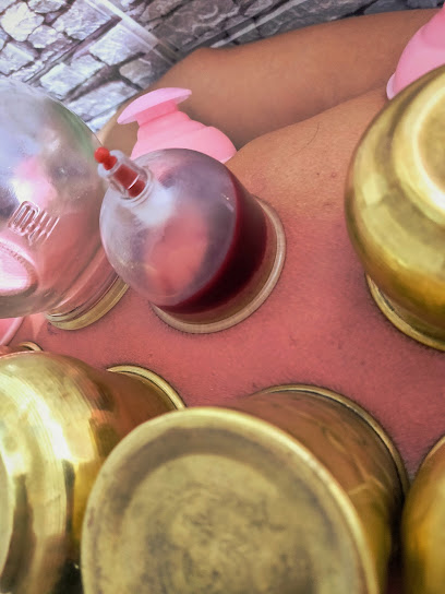 Centre Bouzid pour Hijama de la Ventousothérapie