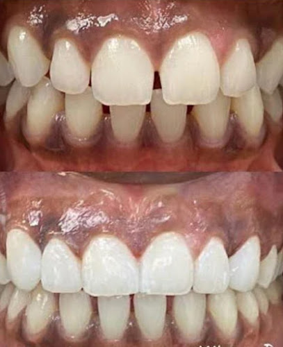 عيادة ابتسامة هوليود للاسنان